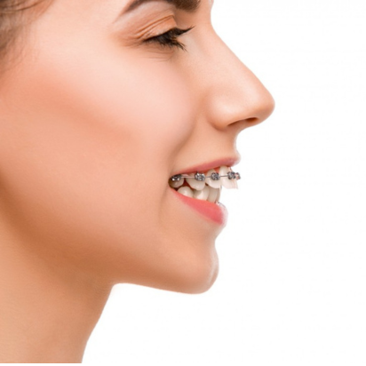 Beyond Straight Teeth: Unlocking Your Dream Smile with Modern Orthodontics